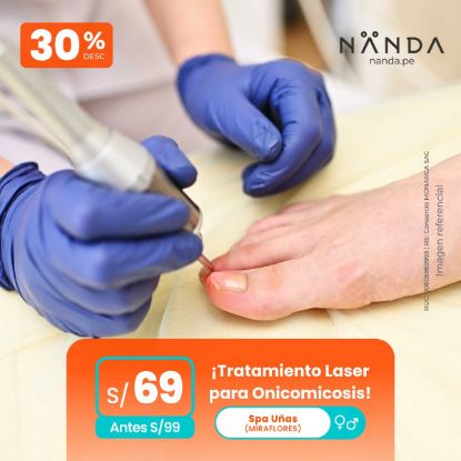 ¡Tratamiento Laser para Onicomicosis! 😍 - Spa Uñas (MIRAFLORES)