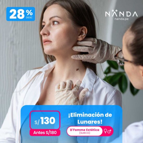 ¡Eliminación de lunares! 😍 - D'Femme Estética (SURCO)