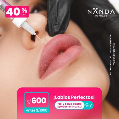 ¡Labios Perfectos! 😍 - Piel y Salud Centro Estético (MIRAFLORES)