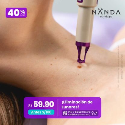 ¡Eliminación de Lunares! 😍 - Piel y Salud Centro Estético (MIRAFLORES)