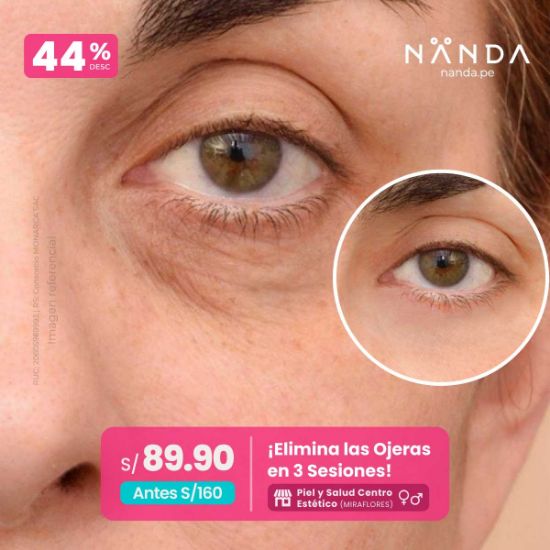 ¡Elimina las Ojeras en 3 Sesiones! 😍 - Piel y Salud Centro Estético (MIRAFLORES)