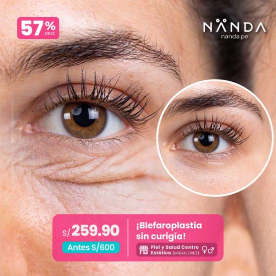 ¡Blefaroplastía sin curigía! 😍 - Piel y Salud Centro Estético (MIRAFLORES)