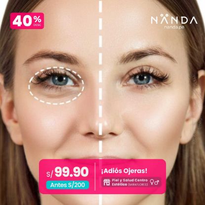 ¡Adiós Ojeras! 😍 - Piel y Salud Centro Estético (MIRAFLORES)