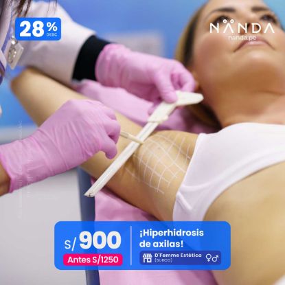 ¡Hiperhidrosis de axilas! 😍 - D'Femme Estética (SURCO)