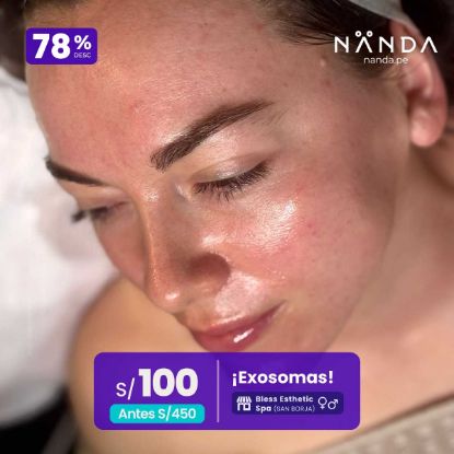 ¡Exosomas! 😍 - Bless Esthetic Spa (SAN BORJA)