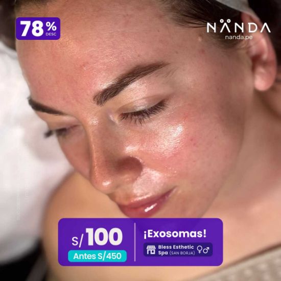 ¡Exosomas! 😍 - Bless Esthetic Spa (SAN BORJA)