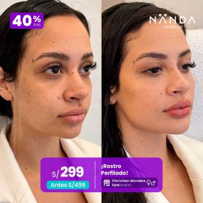¡Rostro Perfilado! 😍 - Christian Morales Spa (SURCO)